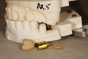 Killian Dental Ceramics, CDL Photo