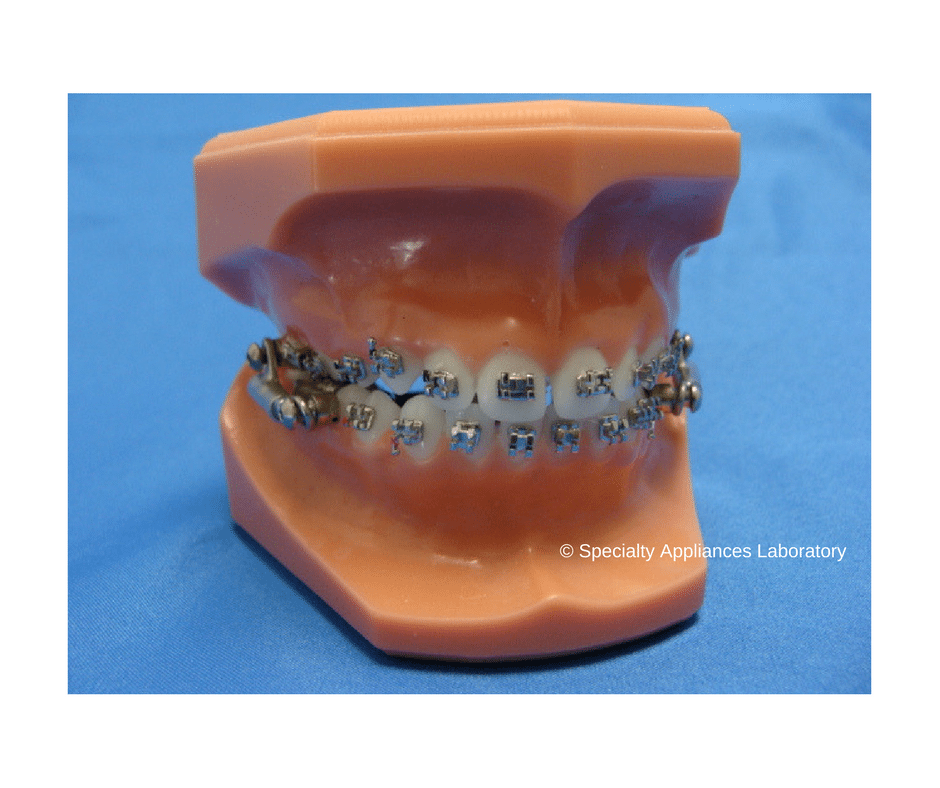 What’s in your mouth? Orthodontics What's in Your Mouth?