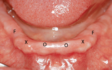 Chris Bormes_Blog 2_ Photo #11