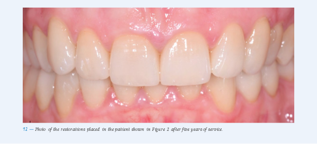 Fig 12